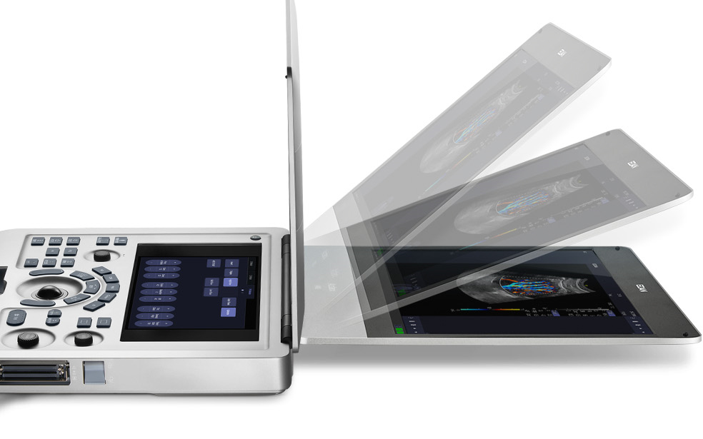 Acclarix AX2 touch scherm v2